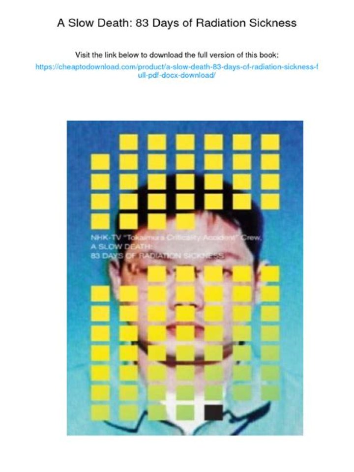 83 Days of Radiation Sickness The Death of Hisashi Ouchi True Horror