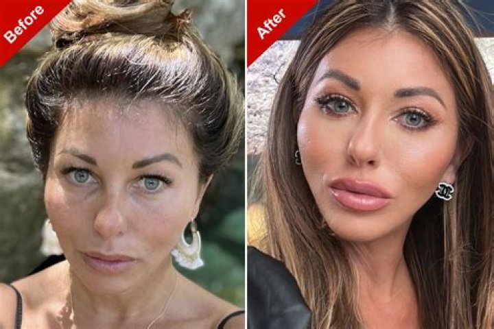 Belle Delphine No Makeup Look: Plastic Surgery Before-After