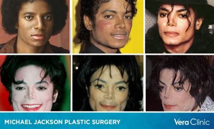 Country Singer Alan Jackson Plastic Surgery: Did He Have A Facelift?