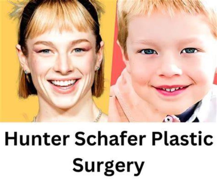 Did Euphoria Jules have bottom surgery? Before and After Photographs of