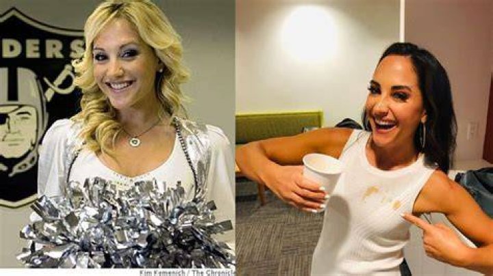 Emily Compagno Plastic Surgery Nose Job, Facelift, Boob Job, and More