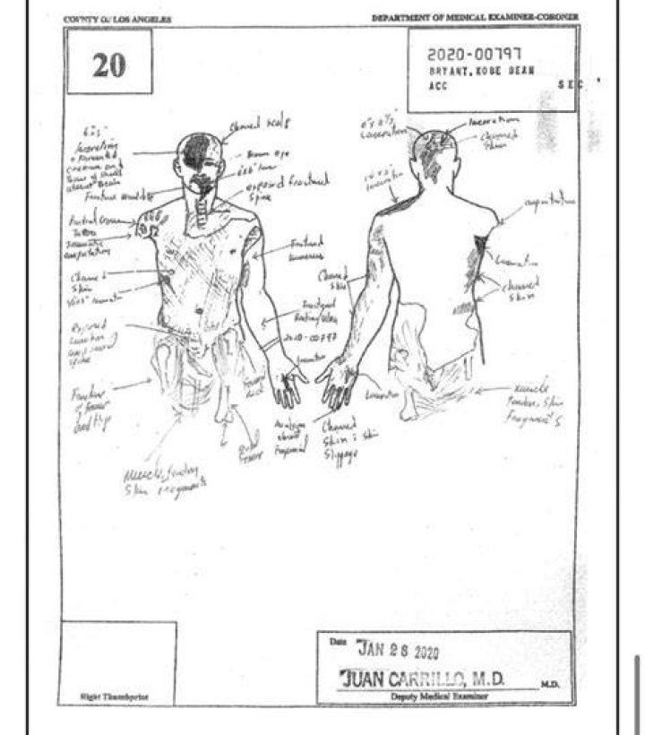 Gianna Bryant Autopsy Report Drawing What Caused Gigi's Horrific Death?