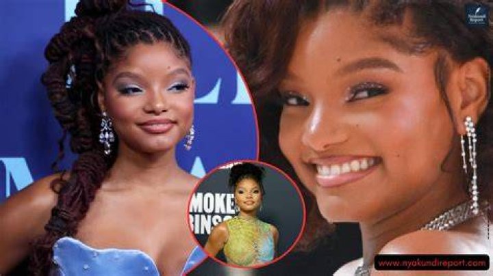 Halle Bailey Disability Health Report and Net Worth TFunter