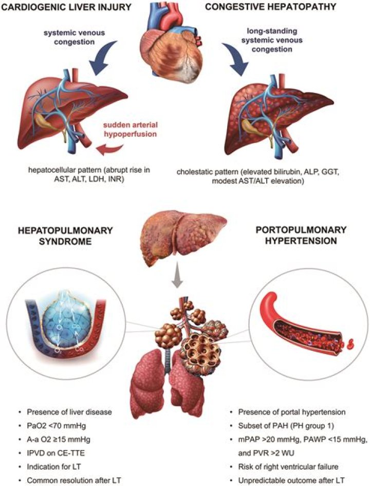 Heart Attack Or Liver Damage