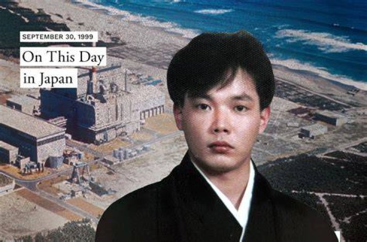 Hisashi Ouchi History's Worst Radiation Victim Kept Alive For 83 Days