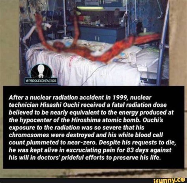 Hisashi Ouchi The Most Radioactive Man in History New York Gal