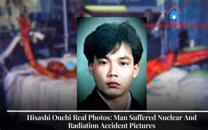 Hisashi Ouchi The Real Story Behind The Photos