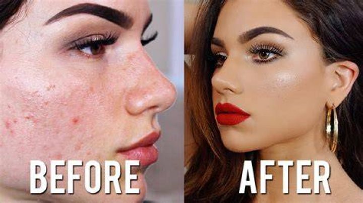 How to cover acne scars with makeup, according to a pro