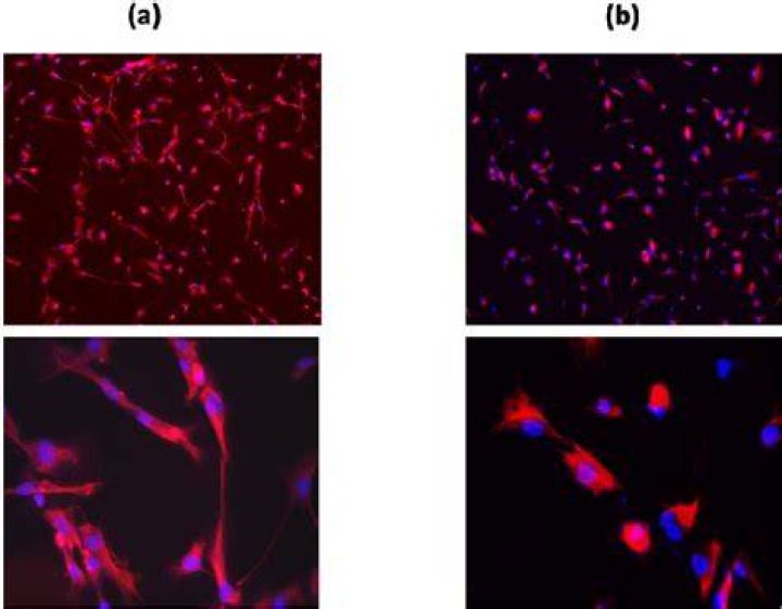 Human primary Schwann cell cultures maintained in vitro for 2 weeks in