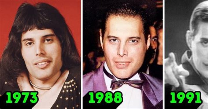 Is He Becoming A Meme Star Because Of His Teeth?