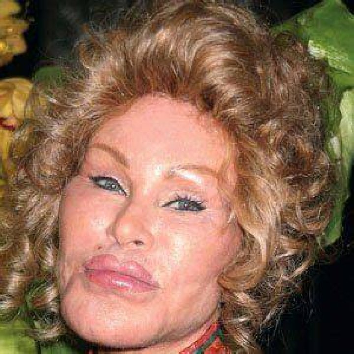 Jocelyn Wildenstein Biography Facts, Childhood, Family of Socialite
