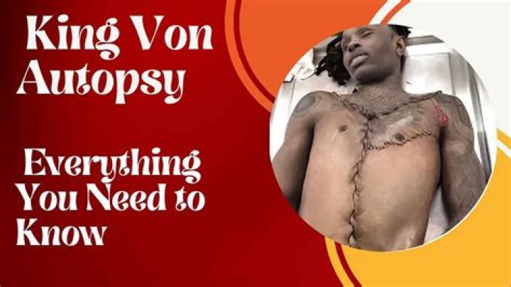 King Von Autopsy Understanding The Impact Of His Life And Death