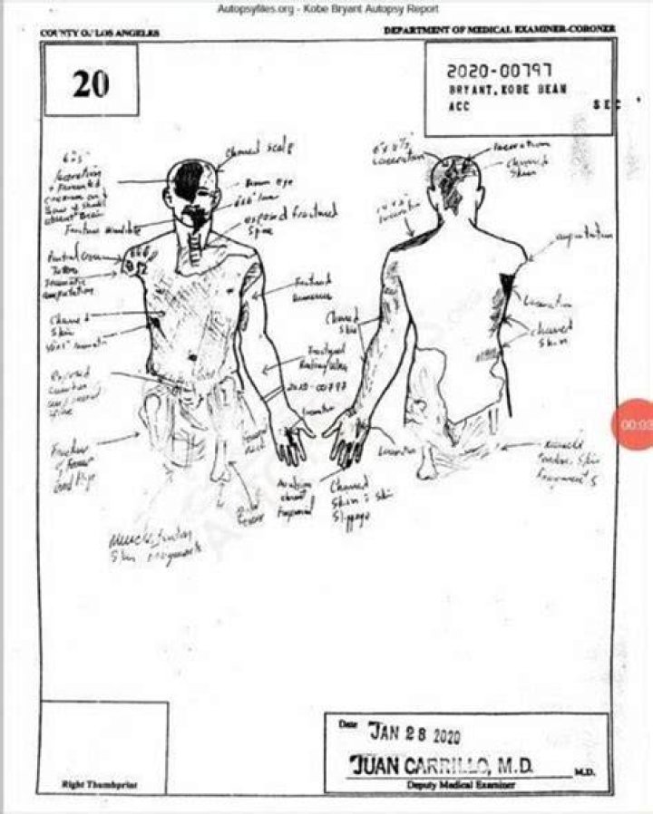 Kobe Bryant Autopsy Report ABTC