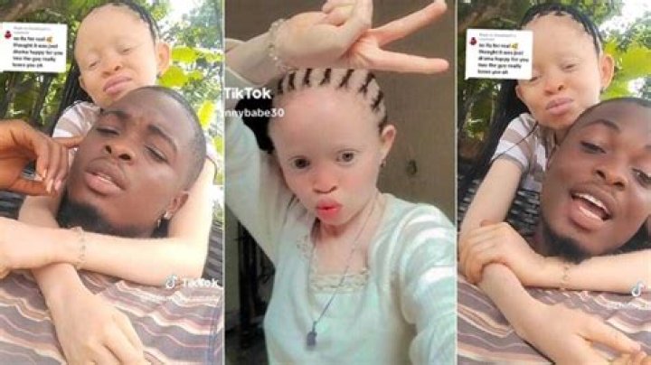 "Nobody Will Breathe Again": Albino Lady Finally Finds Love after Years of Searching, Video Trends