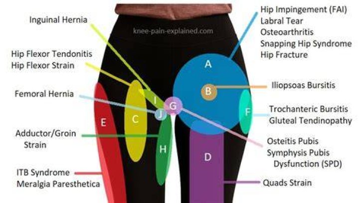 OYA Leggings Help Keep My Groin Area Sweat-Free