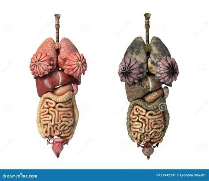 Pleins Organes Internes Femelles, Healty Et Unhealty. Illustration