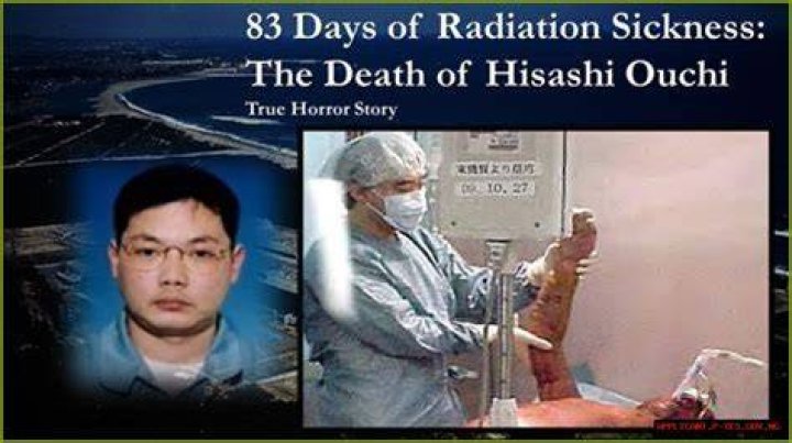 Remembering Hisashi Ouchi The Tragic Story Of His Life And Death