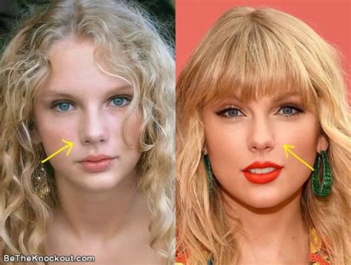 Taylor Russell Nose Job: Before And After Photos